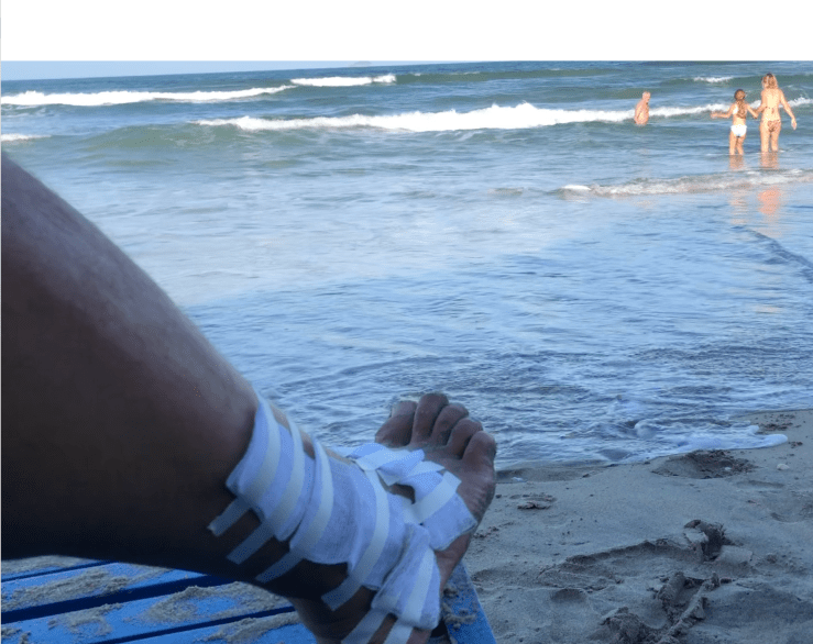 Blessure de guerre - Hoi An - Vietnam